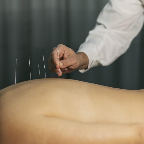 proceso-acupuntura (1)